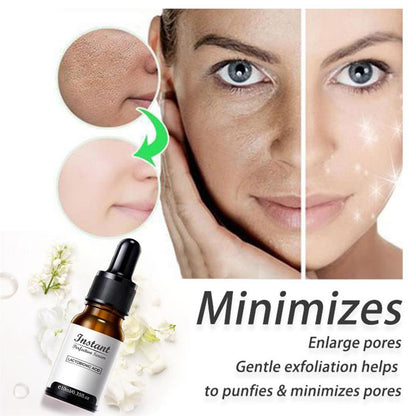 DermaYouth – Argireline Anti-Aging-Formel