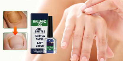 VitaNail – Intensiv-Stift gegen Nagelpilz
