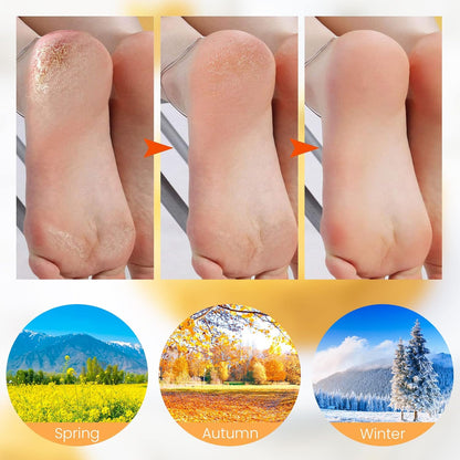 Calcetines VelvetHeel – Cuidado para pies de piel suave
