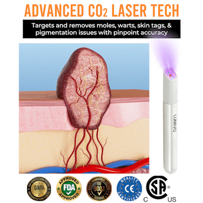 CleanBeam – Multifunktions-CO₂-Laser-Radierstift