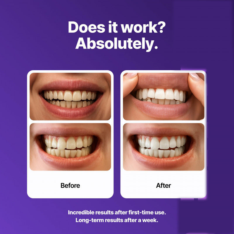 BrightViolet - Tiras blanqueadoras de dientes moradas