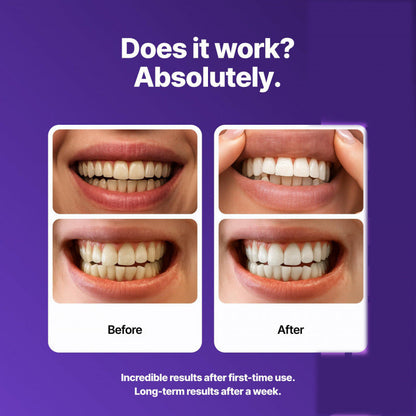 BrightViolet - Tiras blanqueadoras de dientes moradas
