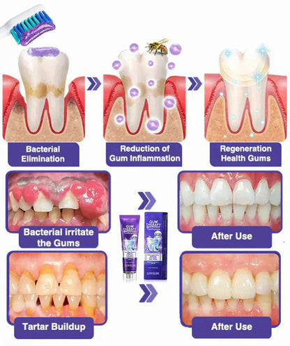 Dentova – Pasta de dientes con veneno de abeja para el cuidado dental
