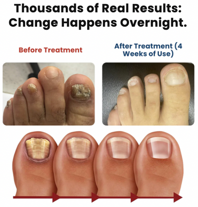 NailRevive Pro – Parches de Cuidado Profundo