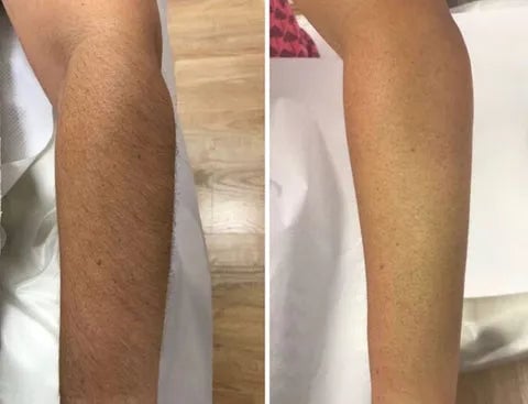 GlowSmooth – Feuchtigkeitsspendendes Haarentfernungsspray