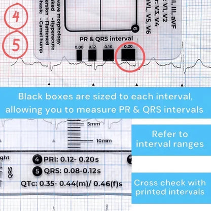 MediTrack – Guía de bolsillo para la evaluación profesional de ECG