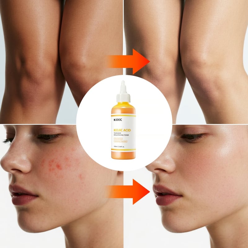 PureGlow – Suero Iluminador Herbal con Ácido Kójico