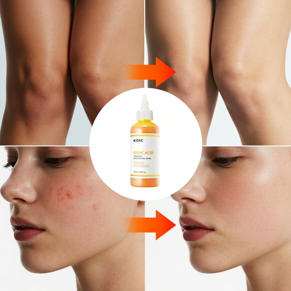 PureGlow – Suero Iluminador Herbal con Ácido Kójico