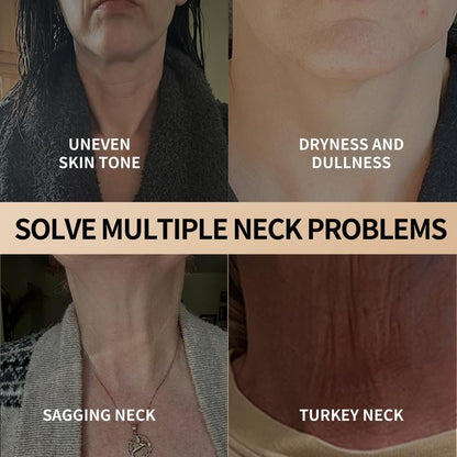 SoftDerm – Cuidado de hidratación total para pieles sensibles