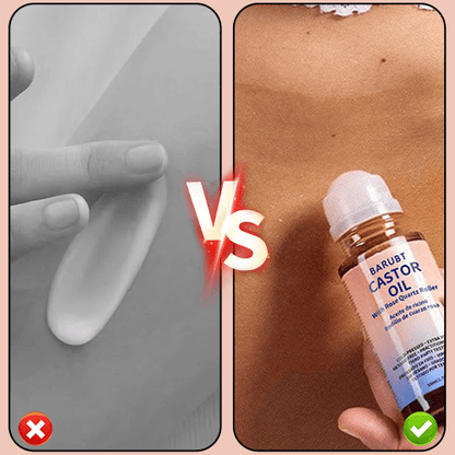 PureTouch – Aceite de ricino Roll-On