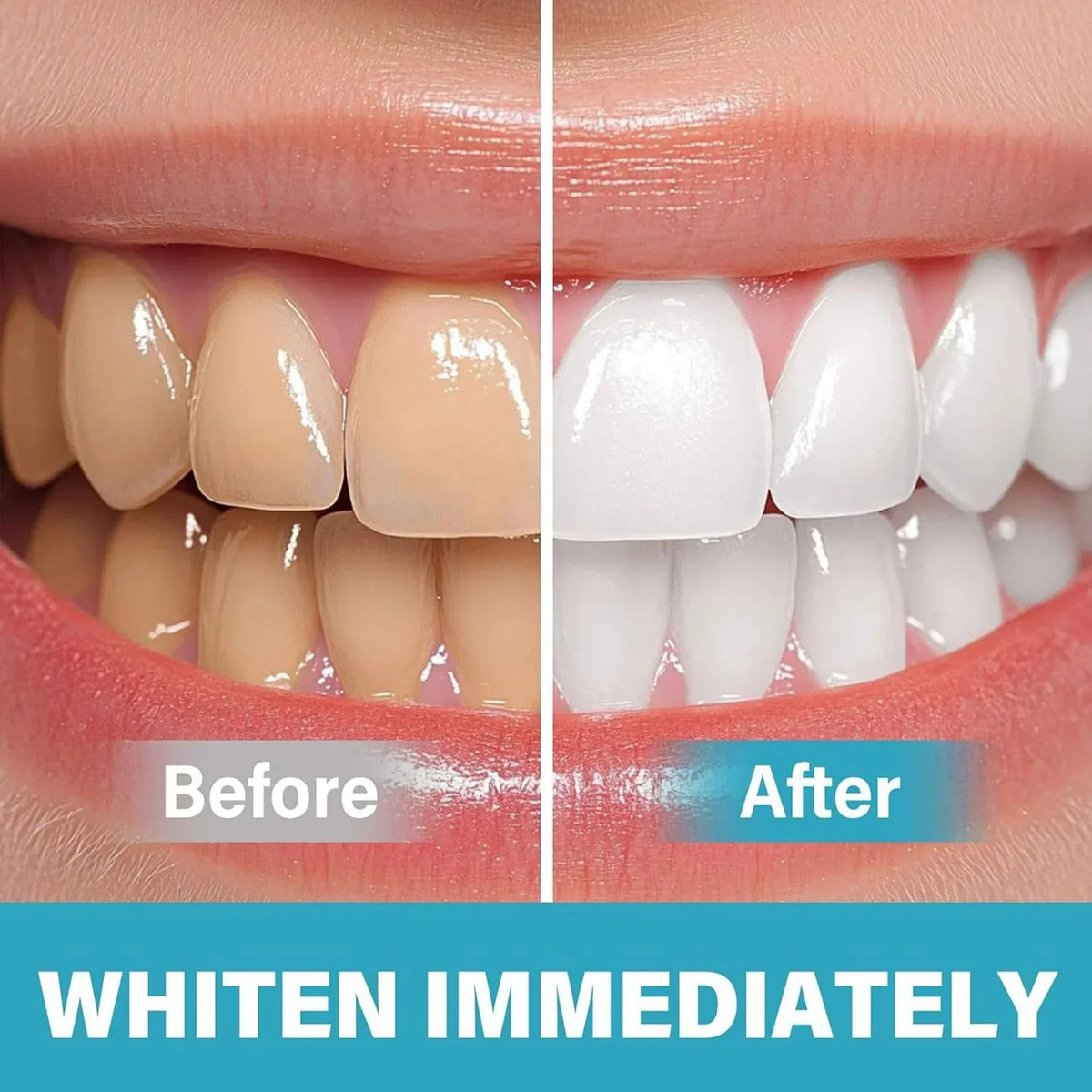 SmileBright- Pigmento Blanqueador Dental Instantáneo