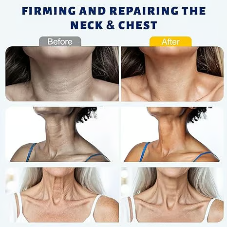 DermaRoll Cuello – Crema Escultora Lifting