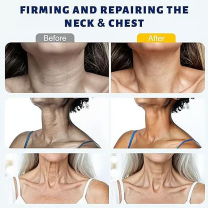 DermaRoll Cuello – Crema Escultora Lifting