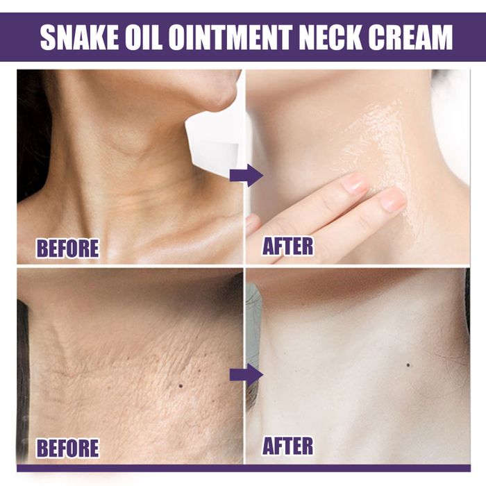 SkinLift – Crema Hidratante y Suavizante Reafirmante para el Cuello