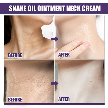 SkinLift – Crema Hidratante y Suavizante Reafirmante para el Cuello