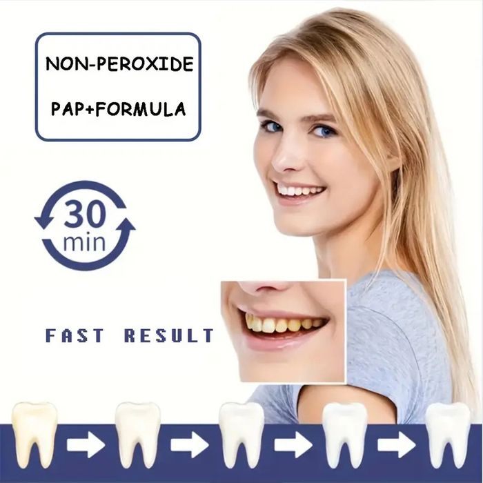 AuraBright – Tiras blanqueadoras de dientes avanzadas PAP+