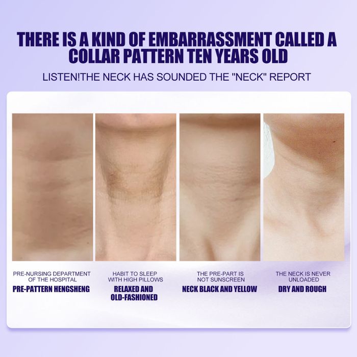 SkinLift – Crema Hidratante y Suavizante Reafirmante para el Cuello