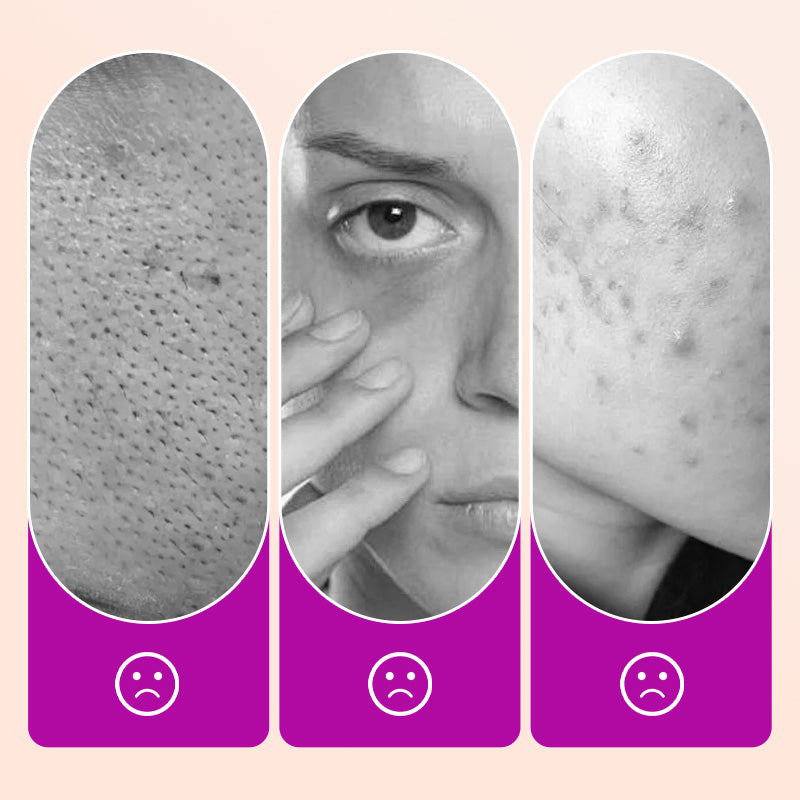 SkinPerfect – Set de brochas de corrector de cobertura total
