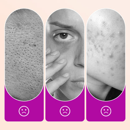 SkinPerfect – Set de brochas de corrector de cobertura total
