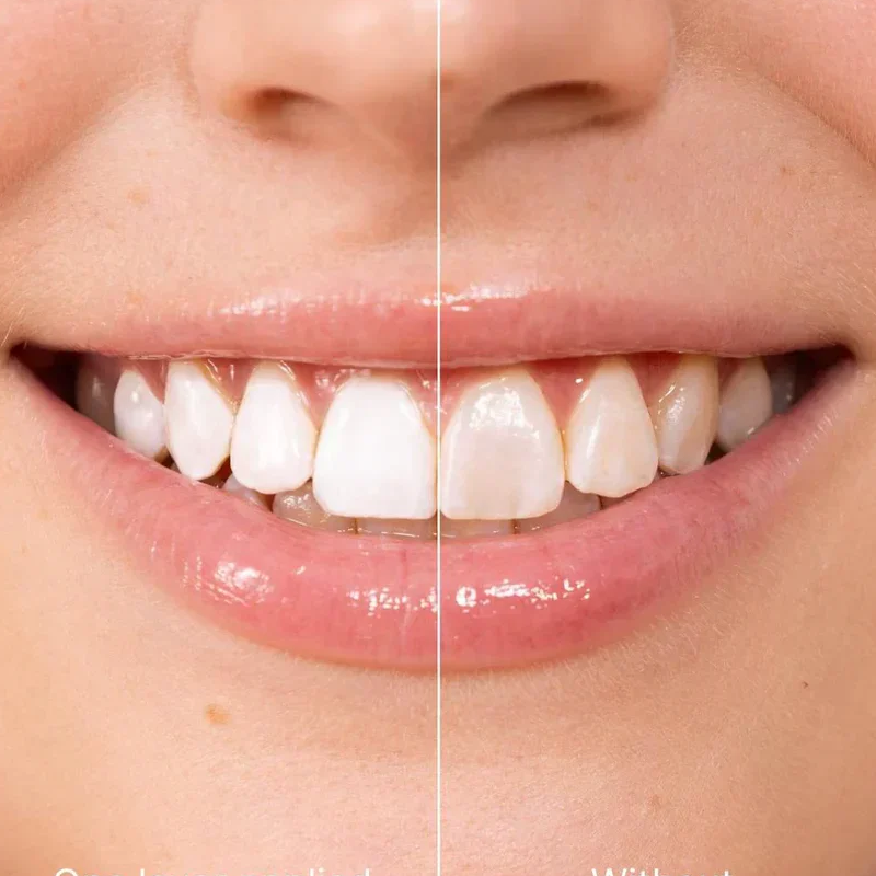 WhiteBloom – Blanqueador de sonrisa instantáneo