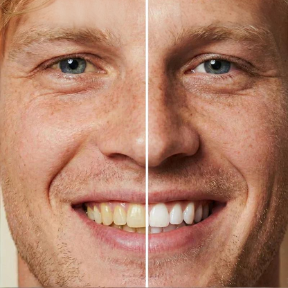 WhiteBloom – Blanqueador de sonrisa instantáneo
