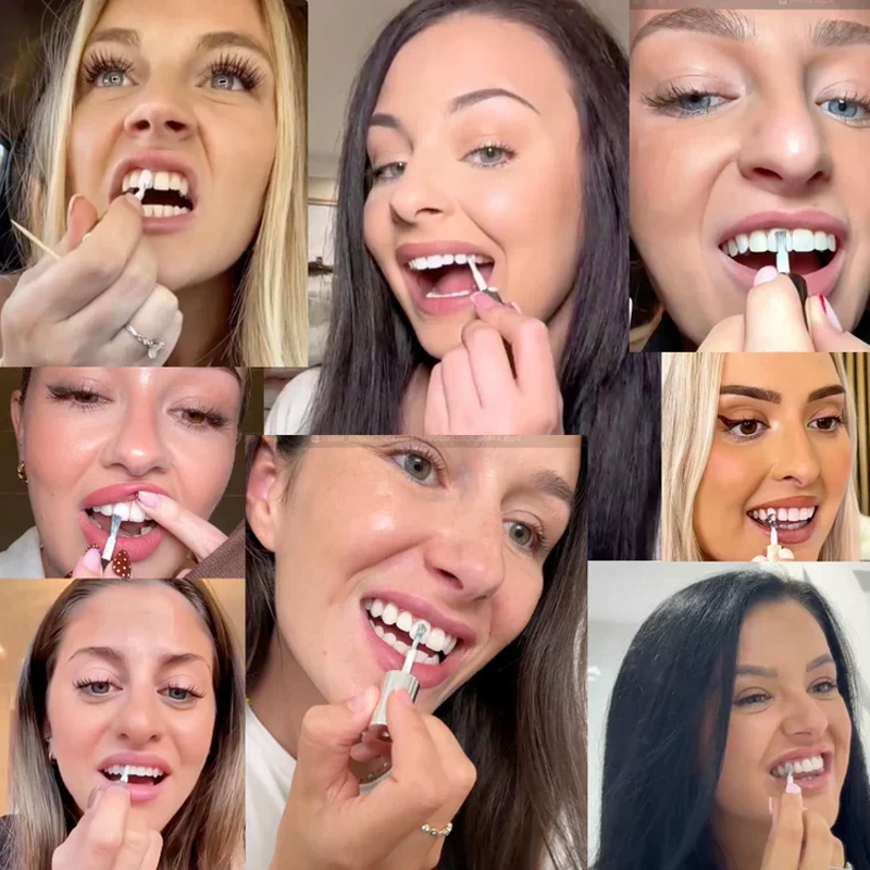WhiteBloom – Blanqueador de sonrisa instantáneo