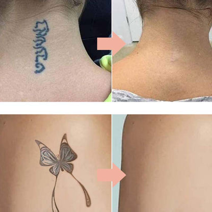 FadeEase – Sanfte Creme zur Tattoo-Aufhellung