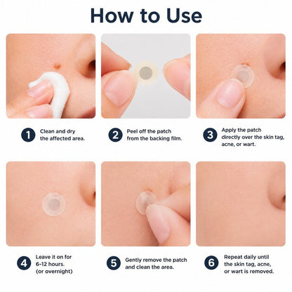 SkinNova – Parche para Acné con Microneedles de Doble Acción