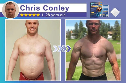 ⚕️💙Slimoly® Gynecomastia Chest Fatburn & Firm Patch
