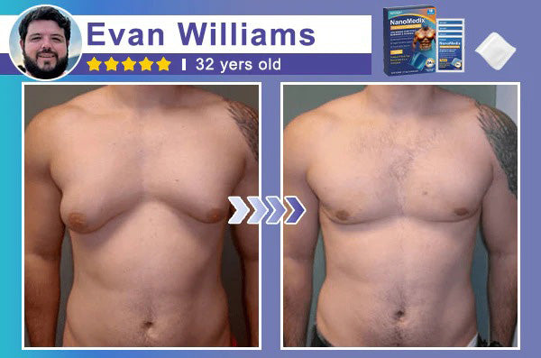 ⚕️💙Slimoly® Gynecomastia Chest Fatburn & Firm Patch