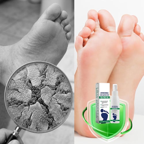 DryStep – Spray para Pies con Control del Sudor